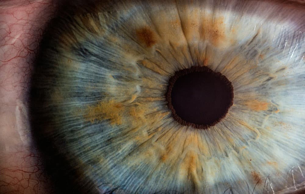 Palamu Neuro & Eye Care 2